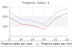 order finpecia 1 mg online