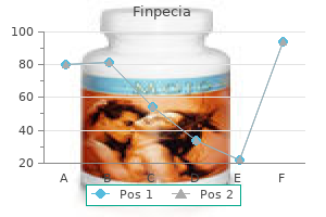 cheap 1 mg finpecia overnight delivery