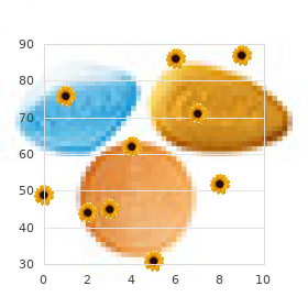 Creutzfeldt Jakob disease