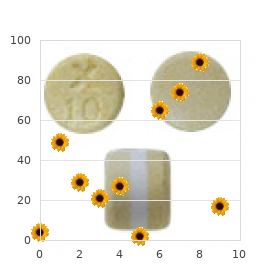 Pterygia mental retardation facial dysmorphism