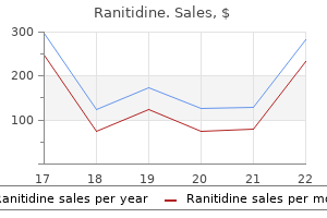 ranitidine 300 mg buy with visa