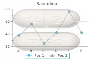 ranitidine 300 mg buy cheap line