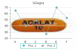 silagra 50 mg buy amex