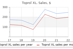 effective toprol xl 50 mg