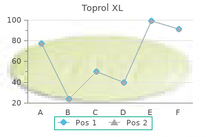 purchase toprol xl 100 mg amex